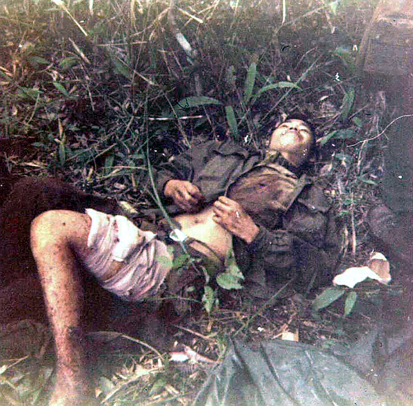 The Enemy is your Enemy
NVA wounded and "Doc" fixed him up.  He showed his "thanks" by promptly spitting on Doc.  Then we had to cut an LZ to airlift him out.
